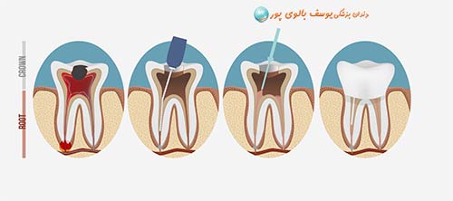 دندانپزشکی دکتر بالوی پور