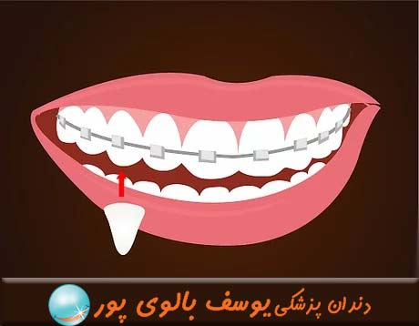 مطب دندانپزشکی سعادت آباد