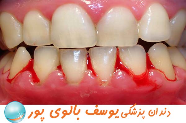 دندانپزشکی شبانه روزی دکتر یوسف بالوی پور