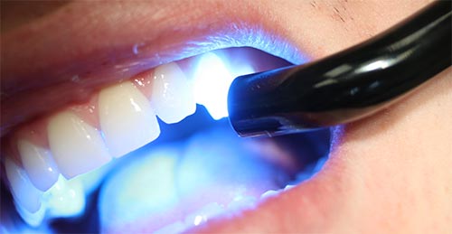 دندانپزشکی زیبایی بالوی پور
