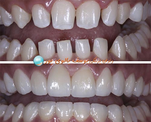 زیبایی دندان را در کلینیک دکتر بالوی پور تجربه کنید