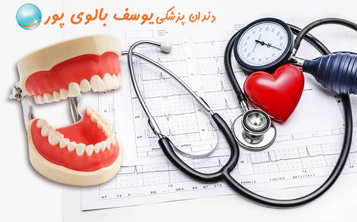 فشار خون و دندانپزشکی