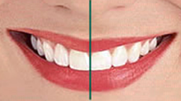 متخصص زیبایی دندان در سعادت آباد